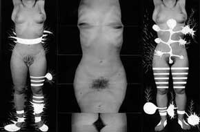 Urgence des peaux